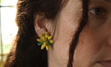 מדוע מתרחשת נשירת שיער אצל נשים?