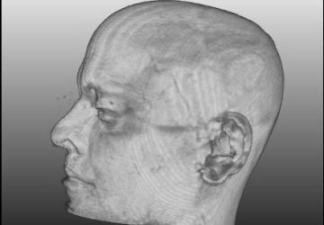 עולם הדימות: אולטראסאונד, MRI ו-CT