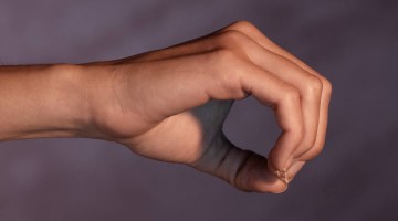 שמונה שאלות על דלקת מפרקים שגרונית